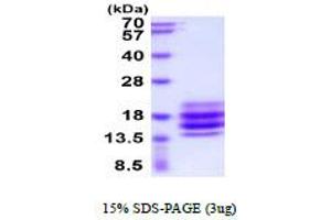 SDS-PAGE (SDS) image for CD90 (THY1) (AA 20-130) protein (His tag) (ABIN6387867)