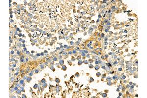 Phospho-DDR1 (Tyr180) Antibody at 1/100 staining Rat testis tissue by IHC-P. (DDR1 抗体  (pTyr180))