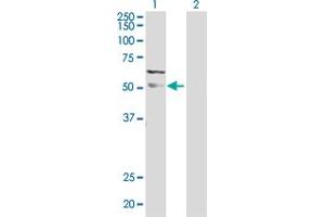 Western Blot analysis of MAPK9 expression in transfected 293T cell line by MAPK9 MaxPab polyclonal antibody. (JNK2 抗体  (AA 1-424))
