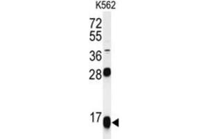 Western Blotting (WB) image for anti-Ribosomal Protein S15a (RA) antibody (ABIN3002138) (RPS15A 抗体)