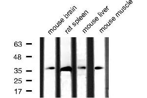 Western blot analysis of extracts of various tissue sample,using Caspase 3 Antibody . (Caspase 3 抗体  (Internal Region))