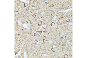Immunohistochemistry (IHC) image for anti-Calcium/calmodulin-Dependent Protein Kinase II beta (CAMK2B) antibody (ABIN1679768)