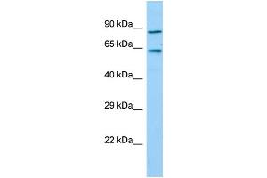 Host: Rabbit Target Name: TIGD7 Sample Type: Hela Whole Cell lysates Antibody Dilution: 1. (TIGD7 抗体  (C-Term))