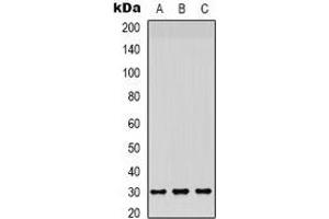 Western blot analysis of CD66c/d expression in HepG2 (A), A549 (B), mouse brain (C) whole cell lysates.