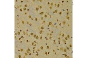 Immunohistochemistry (Paraffin-embedded Sections) (IHC (p)) image for anti-Histone 3 (H3) (H3K9me3) antibody (ABIN3016030)