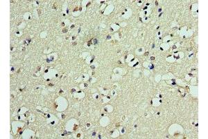 Immunohistochemistry of paraffin-embedded human brain tissue using ABIN7150359 at dilution of 1:100 (DEDD2 抗体  (AA 1-240))