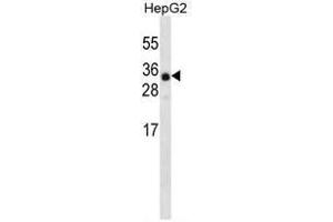 ANR46 Antibody (N-term) western blot analysis in HepG2 cell line lysates (35 µg/lane). (ANKRD46 抗体  (N-Term))