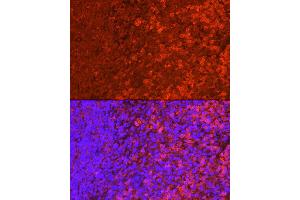 Immunofluorescence (IF) image for anti-Inositol Polyphosphate-5-Phosphatase, 145kDa (INPP5D) (AA 959-1188) antibody (ABIN6213625)