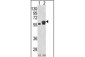 Western blot analysis of PDIA3 (arrow) using rabbit polyclonal PDIA3 Antibody (Center) (ABIN389465 and ABIN2839530). (PDIA3 抗体  (AA 192-220))