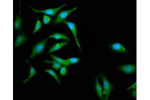 Immunofluorescence staining of Hela cells with ABIN7146380 at 1:133, counter-stained with DAPI. (CABP4 抗体  (AA 1-107))