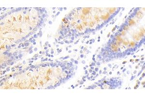 Detection of SCG3 in Human Colon Tissue using Polyclonal Antibody to Secretogranin III (SCG3) (SCG3 抗体  (AA 20-468))