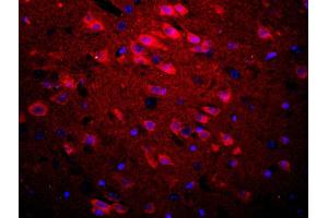 Formalin-fixed and paraffin embedded rat brain labeled with Rabbit Anti-APOE3 Polyclonal Antibody, Unconjugated used at 1:200 dilution for 40 minutes at 37°C. (APOE 抗体  (AA 101-180))