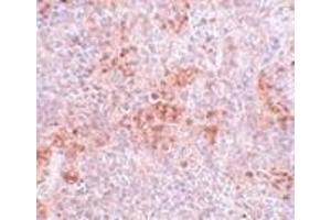 Immunohistochemistry of BFAR in mouse kidney tissue with BFAR antibody at 5 μg/ml. (BFAR 抗体  (C-Term))