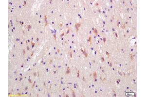 Formalin-fixed and paraffin embedded rat brain labeled with Rabbit Anti Huntingtin Polyclonal Antibody, Unconjugated (ABIN1387692) at 1:200 followed by conjugation to the secondary antibody and DAB staining (Huntingtin 抗体  (AA 751-850))