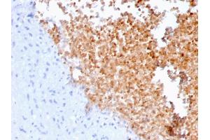 Formalin-fixed, paraffin-embedded human lung stained with Fodrin Mouse Monoclonal Antibody (SPTAN1/3352). (SPTAN1 抗体  (AA 2351-2475))