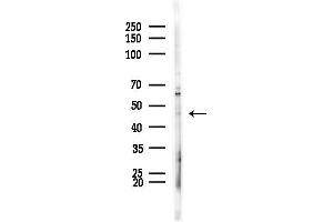 Western blot analysis of lysates from HepG2 cells(LPS, 4h treatment), using APOL5 Antibody at 1/1000 dilution.