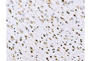 IHC analysis of VPRBP/DCAF1 using anti-VPRBP/DCAF1 antibody (ABIN7602005). (DDB1 and CUL4-Associated Factor 1 (DCAF1) (AA 540-861) 抗体)