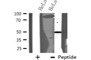 Western blot analysis of extracts from HeLa cells using MAPK10 antibody. (MAPK10 抗体  (C-Term))