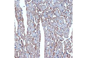 Immunohistochemistry of paraffin-embedded rat heart using CDC42EP1 Rabbit mAb (ABIN7266231) at dilution of 1:100 (40x lens). (CDC42EP1 抗体)