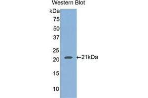 Western blot analysis of the recombinant protein. (HFE2 抗体  (AA 234-416))