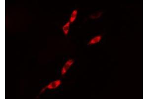 ABIN6276418 staining 293 cells by IF/ICC.