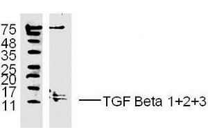 MDA-MB-231 lysates probed with TGF Beta 1+2+3 Polyclonal Antibody, unconjugated  at 1:300 overnight at 4°C followed by a conjugated secondary antibody at 1:10000 for 60 minutes at 37°C. (TGF-beta 抗体  (AA 301-350))