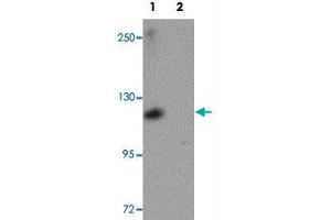 Western blot analysis of ATP11A in K-562 cell lysate with ATP11A polyclonal antibody  at 1 ug/mL in (1) the absence and (2) the presence of blocking peptide. (ATP11A 抗体  (N-Term))