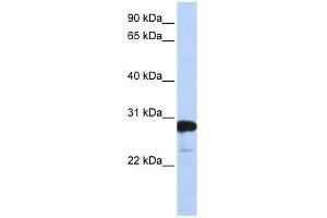 WB Suggested Anti-RANBP1 Antibody Titration:  0. (RANBP1 抗体  (C-Term))