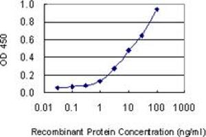 Detection limit for recombinant GST tagged KRT1 is 0. (Cytokeratin 1 抗体  (AA 387-496))