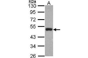 WB Image Sample (30 ug of whole cell lysate) A: Hela 10% SDS PAGE Peripherin antibody antibody diluted at 1:1000