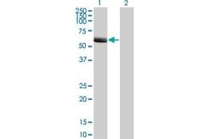Western Blot analysis of LCK expression in transfected 293T cell line by LCK monoclonal antibody (M11), clone 3H5.