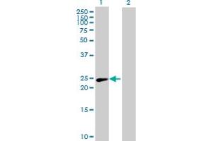 Western Blot analysis of PSMD10 expression in transfected 293T cell line by PSMD10 MaxPab polyclonal antibody. (PSMD10 抗体  (AA 1-226))