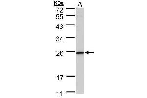 WB Image Sample (30 ug of whole cell lysate) A: HeLa 12% SDS PAGE antibody diluted at 1:1000 (KLRG1 抗体  (Center))