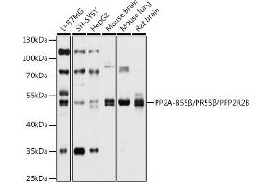 Western blot analysis of extracts of various cell lines, using PP2A-B55β/PR55β/PP2A-B55β/PR55β/PPP2R2B antibody (ABIN6132513, ABIN6146087, ABIN6146088 and ABIN6214771) at 1:1000 dilution. (PPP2R2B 抗体  (AA 160-260))