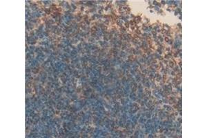 #VALUE! (CD42b 抗体  (AA 17-282))