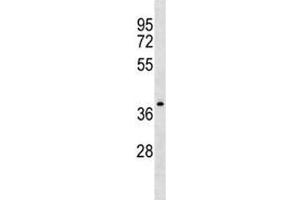 NDRG4 antibody western blot analysis in CEM lysate. (NDRG4 抗体  (AA 193-220))