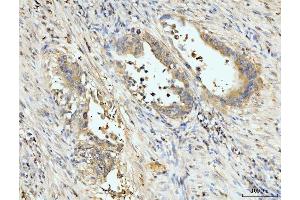 IHC analysis of PDLIM7 using anti-PDLIM7 antibody (ABIN7601048).