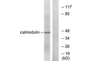 Western blot analysis of extracts from NIH-3T3 cells, using Calmodulin (Ab-79/81) Antibody. (Calmodulin 1 抗体  (AA 46-95))