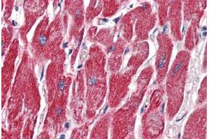 Anti-MMP14 antibody IHC of human heart. (MMP14 抗体  (AA 160-173))