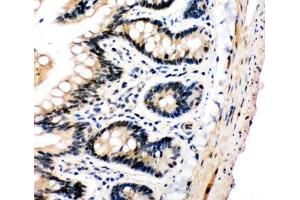 IHC-P: PLK2 antibody testing of rat intestine tissue (PLK2 抗体  (C-Term))