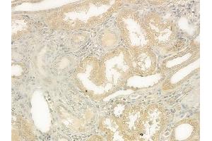 ABIN6263174 and ABIN6273136 at 1/100 staining human normal kidney tissue by IHC-P. (DIAPH1 抗体  (N-Term))
