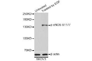 Western blot analysis of extracts of SKOV3 cells, using Phospho-eNOS-S1177 antibody (ABIN5995597). (ENOS 抗体  (pSer1177))