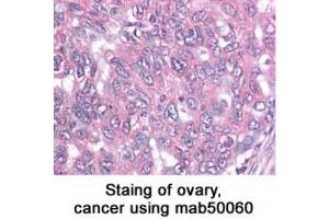 Image no. 2 for anti-Baculoviral IAP Repeat-Containing 5 (BIRC5) antibody (ABIN363214) (Survivin 抗体)