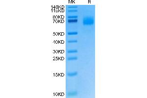 SDS-PAGE (SDS) image for Interleukin 23 Receptor (IL23R) (AA 24-353) protein (His tag) (ABIN7275009)