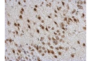 IHC-P Image Immunohistochemical analysis of paraffin-embedded rat brain, using TARDBP, antibody at 1:500 dilution. (TARDBP 抗体)
