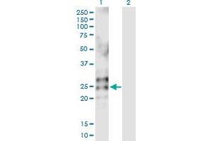 Western Blot analysis of RNASE2 expression in transfected 293T cell line by RNASE2 MaxPab polyclonal antibody. (RNASE2 抗体  (AA 1-161))