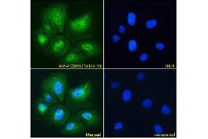 Immunofluorescence (IF) image for anti-Forkhead Box P3 (FOXP3) (C-Term) antibody (ABIN184677)