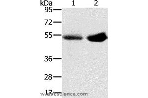 Western blot analysis of Human placenta and plasma tissue, using SLC13A3 Polyclonal Antibody at dilution of 1:200