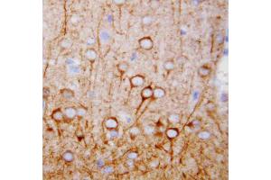 Anti-CaMKK antibody, IHC(P): Rat Brain Tissue (CAMKK1 抗体  (N-Term))