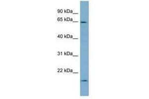 Image no. 1 for anti-Plastin 3 (PLS3) (AA 503-552) antibody (ABIN6749763) (Plastin 3 抗体  (AA 503-552))